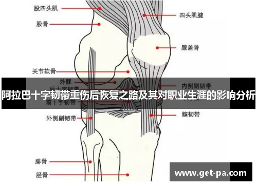 阿拉巴十字韧带重伤后恢复之路及其对职业生涯的影响分析 阿拉巴十字韧带重伤后恢复之路及其对职业生涯的影响分析